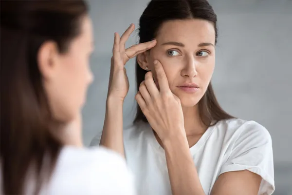 Charlotte-Acne-Scars-Specialist Charlotte Acne Scars Specialist