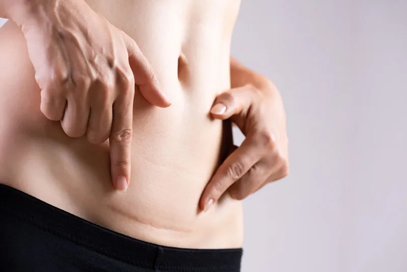 Charlotte-Surgical-Scars-Doctor Charlotte Surgical Scars Doctor
