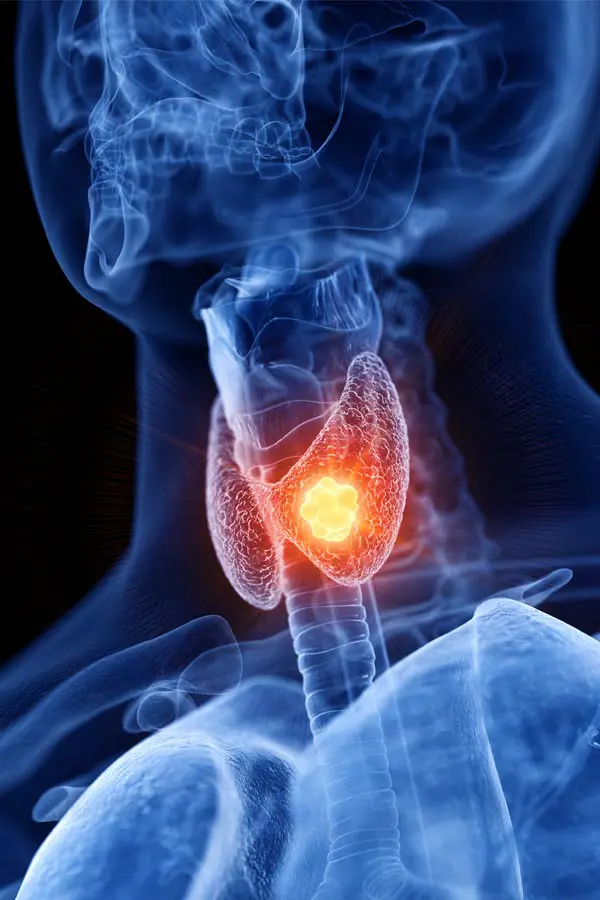 Charlotte-Thyroid-Imbalance-Treatment Charlotte Thyroid Specialist